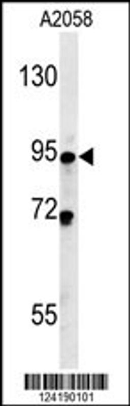 Western blot analysis in A2058 cell line lysates (35ug/lane).