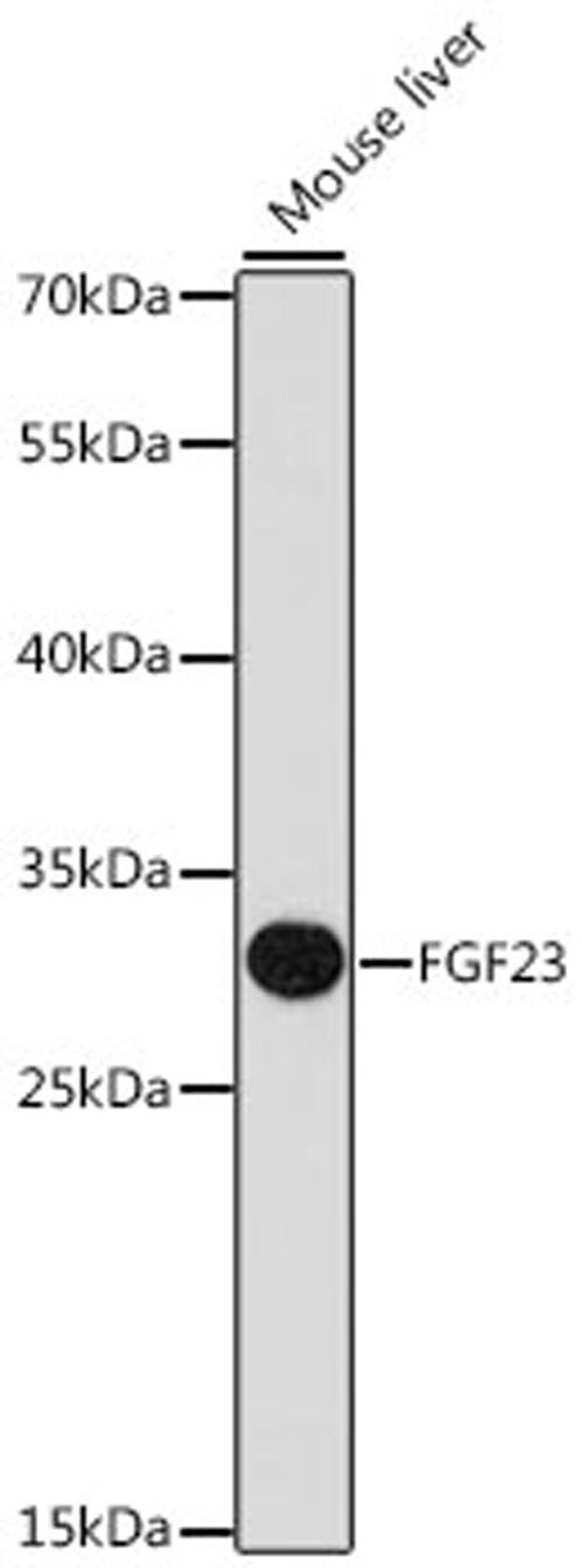 Western blot - FGF23 antibody (A14073)