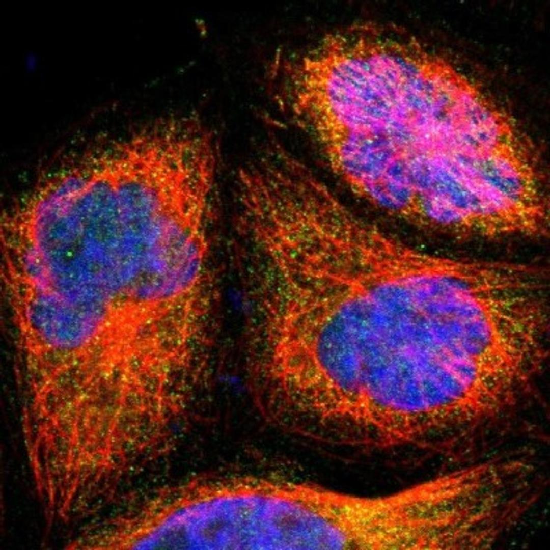 Immunocytochemistry/Immunofluorescence: C22orf29 Antibody [NBP1-93956] - Staining of human cell line A-431 shows positivity in cytoplasm.