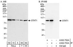 Detection of human and mouse STAT1 by western blot (h&m) and immunoprecipitation (h).