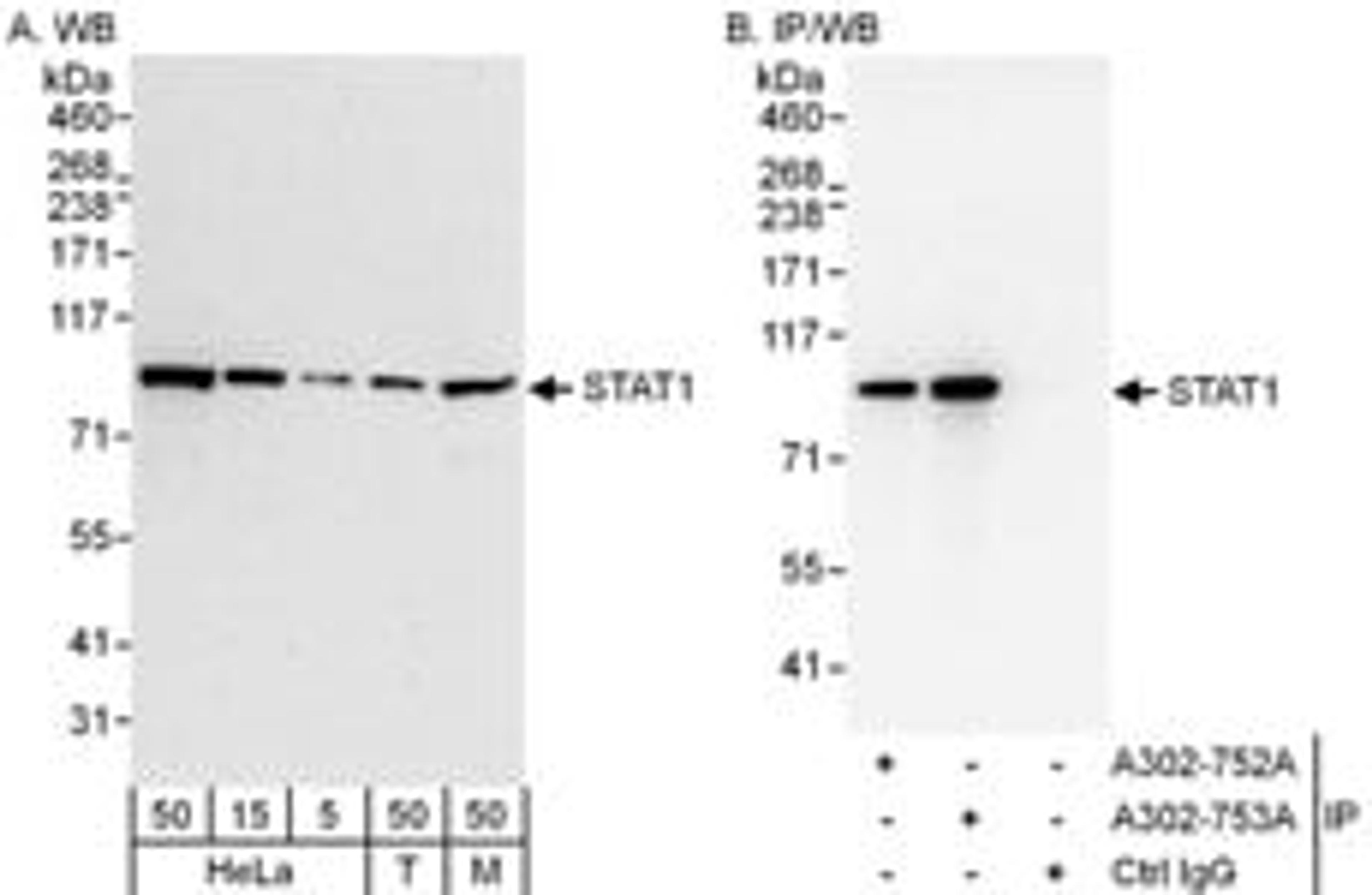 Detection of human and mouse STAT1 by western blot (h&m) and immunoprecipitation (h).