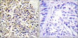 Western blot analysis of RAW264.7 cells using ASC antibody.