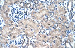 Antibody used in IHC on Human kidney.