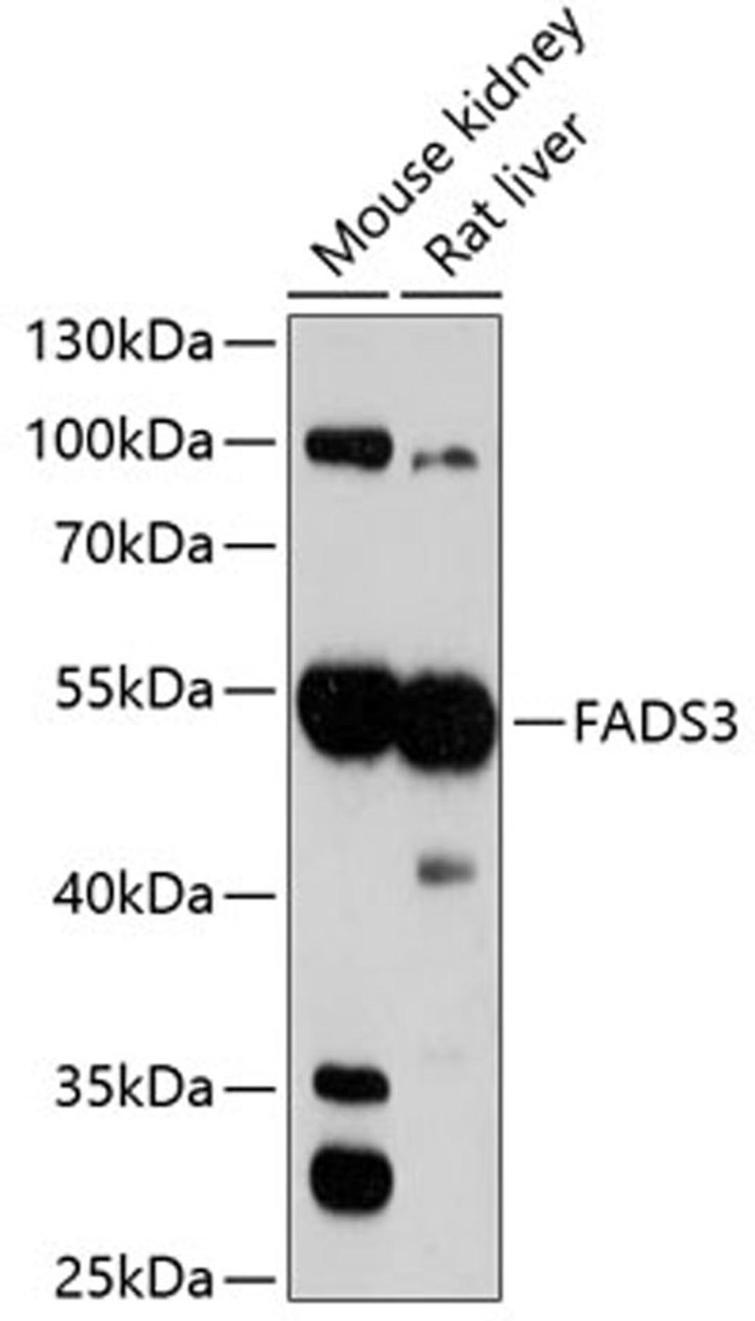 Western blot - FADS3 antibody (A3947)