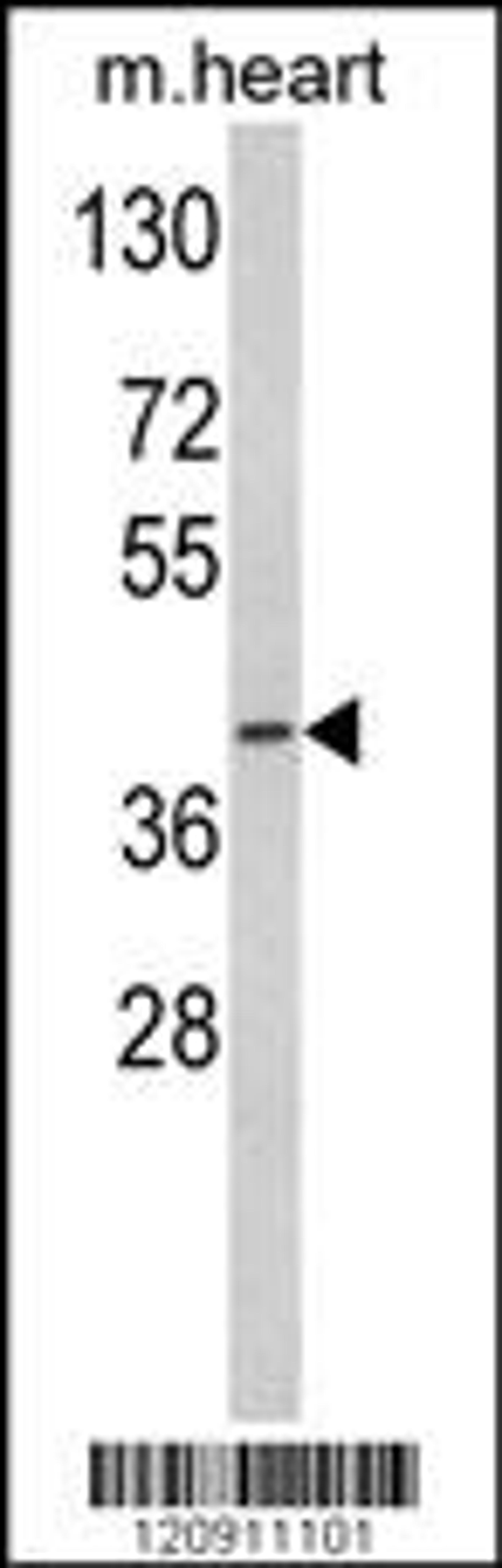 Western blot analysis of ACADM Antibody in mouse heart tissue lysates (35ug/lane)