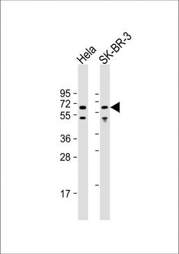 Western Blot at 1:8000 dilution Lane 1: Hela whole cell lysate Lane 2: SK-BR-3 whole cell lysate Lysates/proteins at 20 ug per lane.