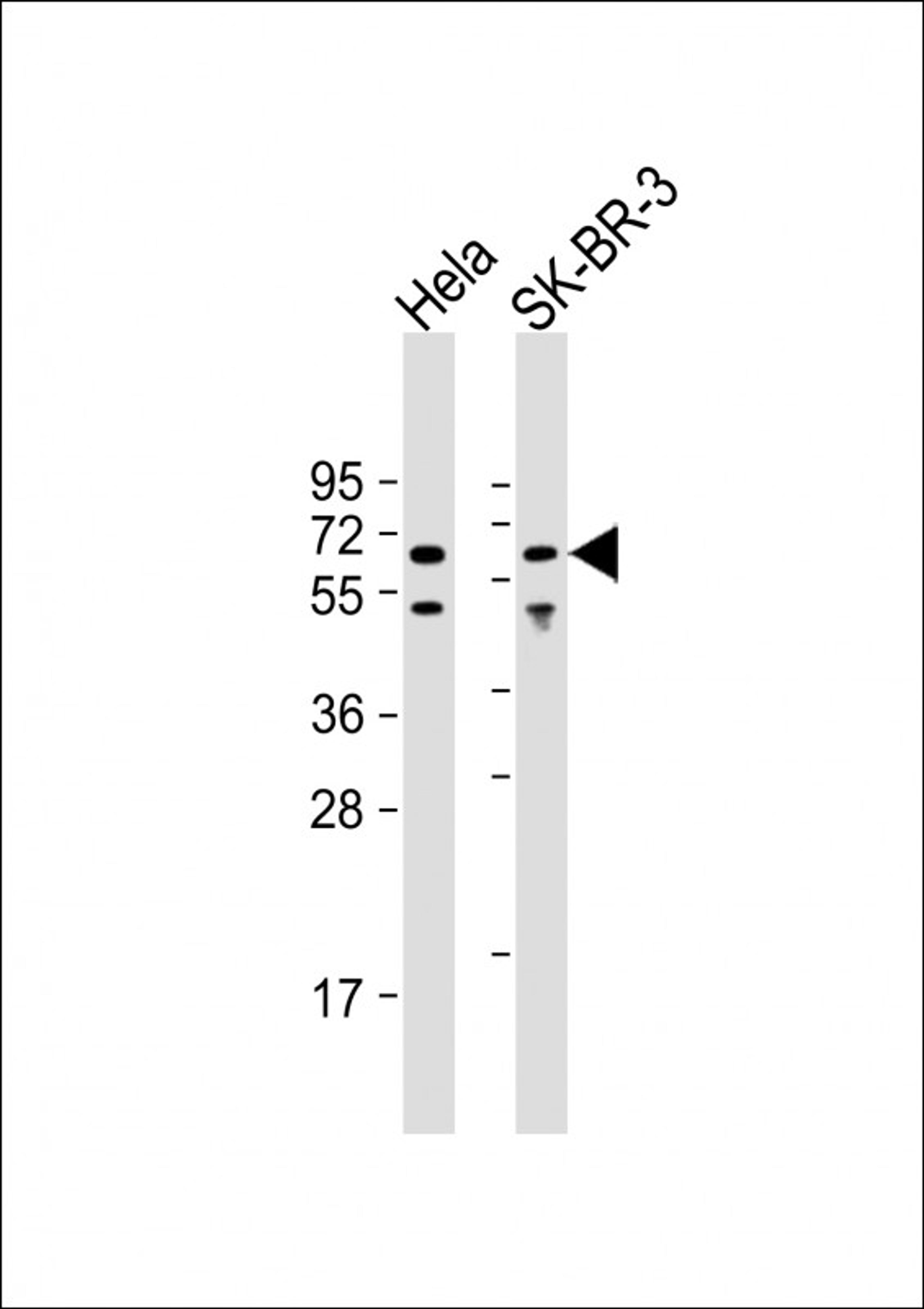 Western Blot at 1:8000 dilution Lane 1: Hela whole cell lysate Lane 2: SK-BR-3 whole cell lysate Lysates/proteins at 20 ug per lane.