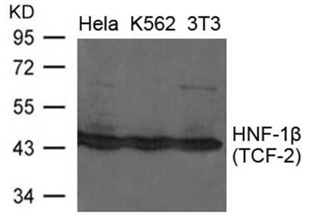 Western blot analysis of extracts from Hela, K562 and 3T3 cells using HNF-1beta antibody