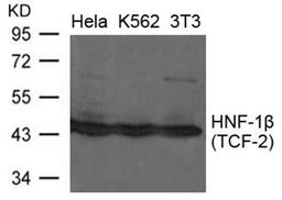 Western blot analysis of extracts from Hela, K562 and 3T3 cells using HNF-1beta antibody