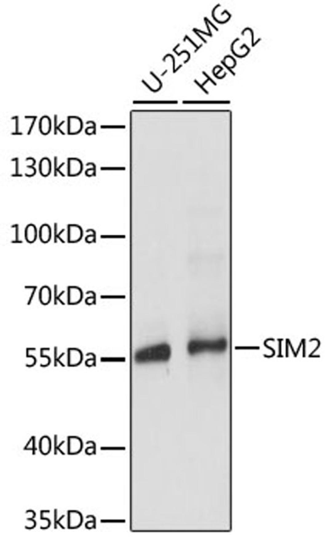 Western blot - SIM2 antibody (A15098)