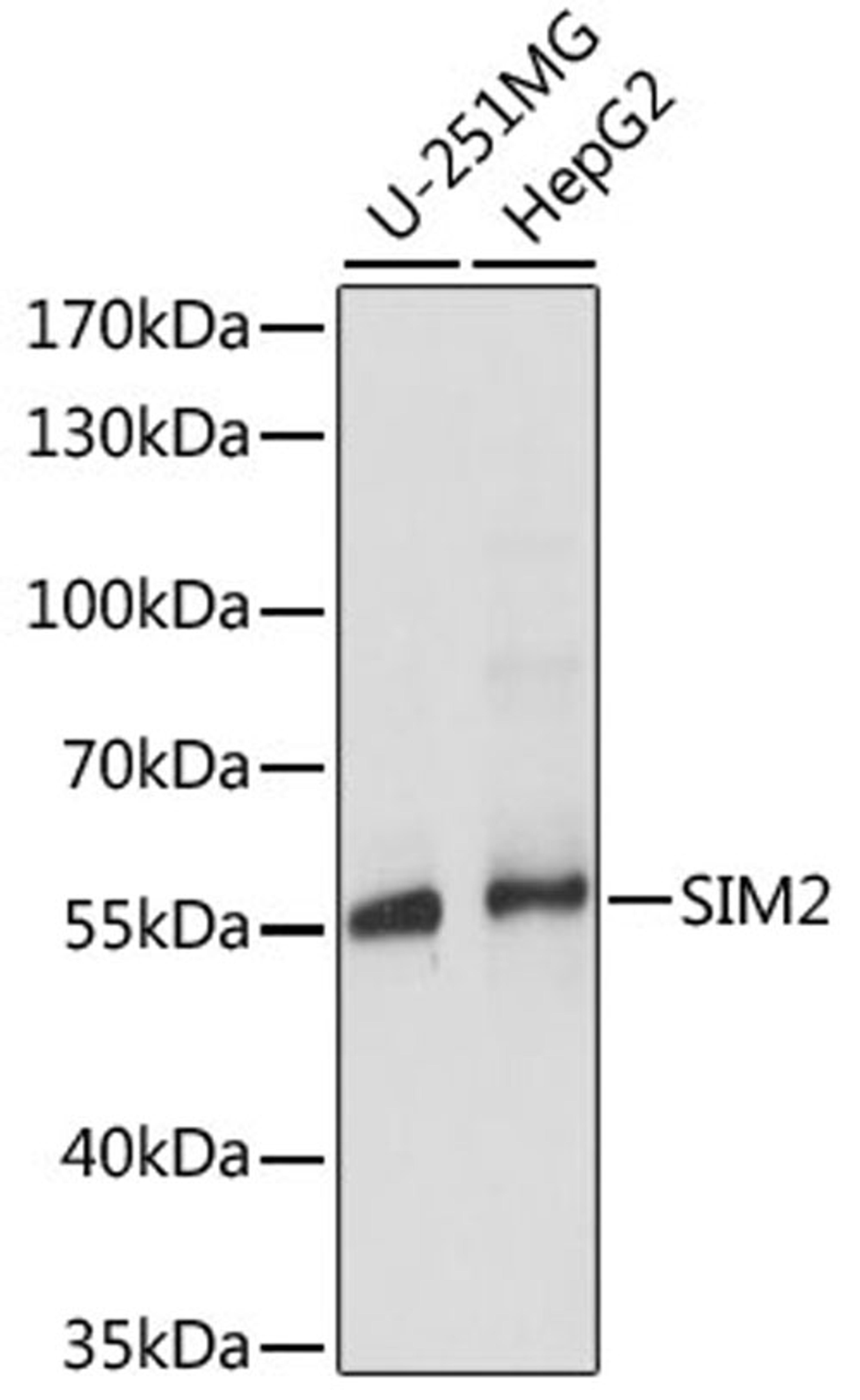 Western blot - SIM2 antibody (A15098)