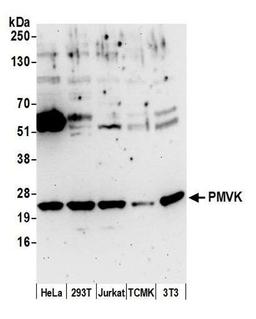 Detection of human and mouse PMVK by WB.