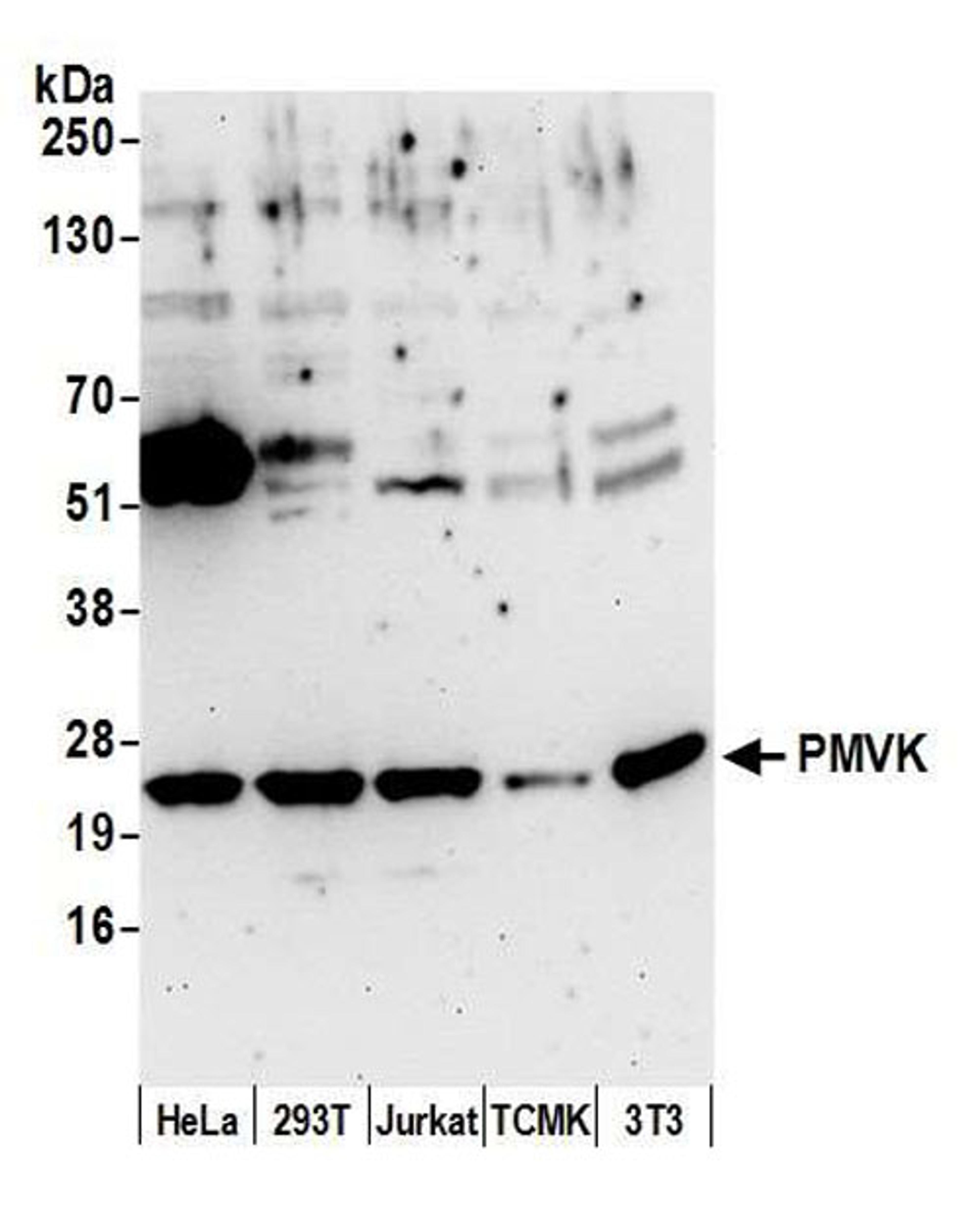 Detection of human and mouse PMVK by WB.