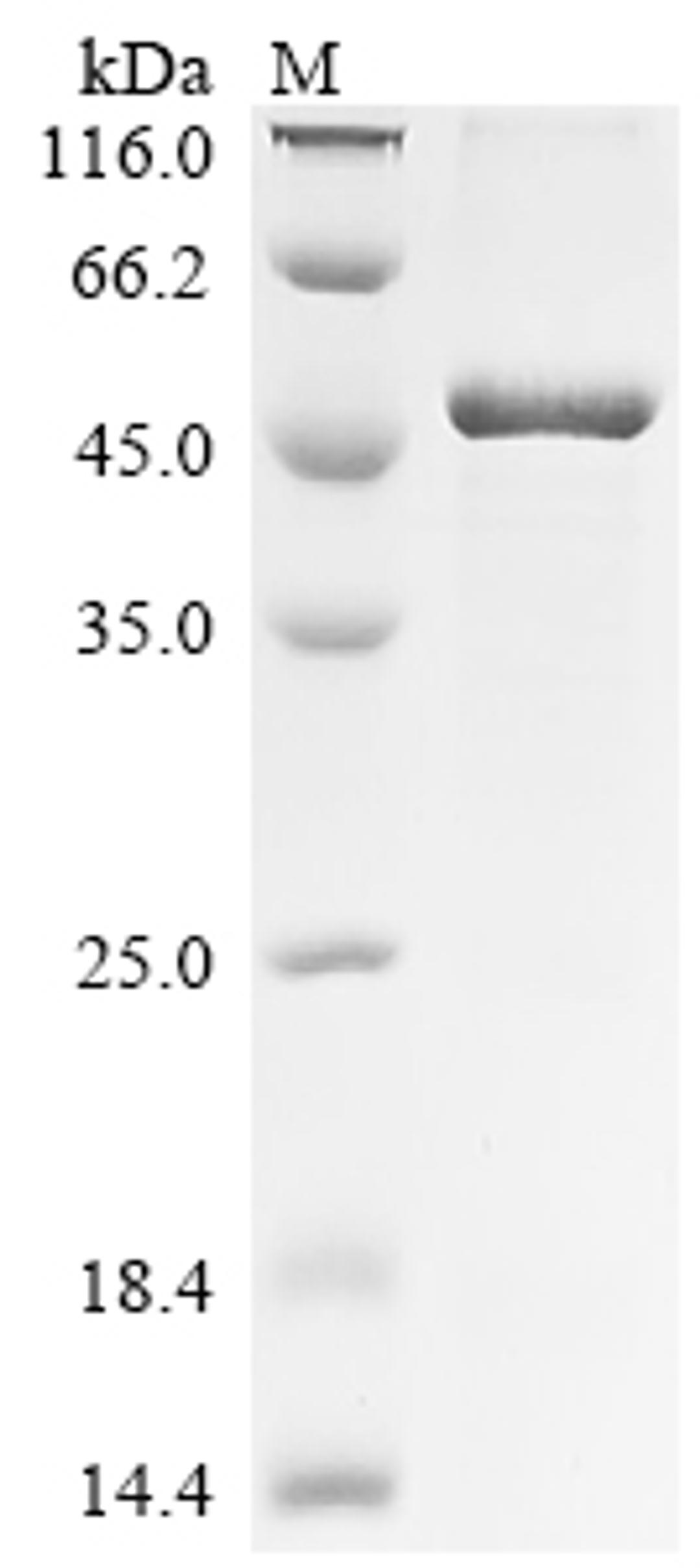 (Tris-Glycine gel) Discontinuous SDS-PAGE (reduced) with 5% enrichment gel and 15% separation gel.