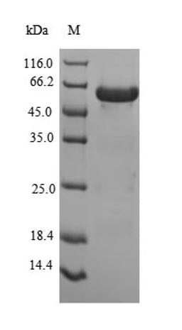 (Tris-Glycine gel) Discontinuous SDS-PAGE (reduced) with 5% enrichment gel and 15% separation gel.