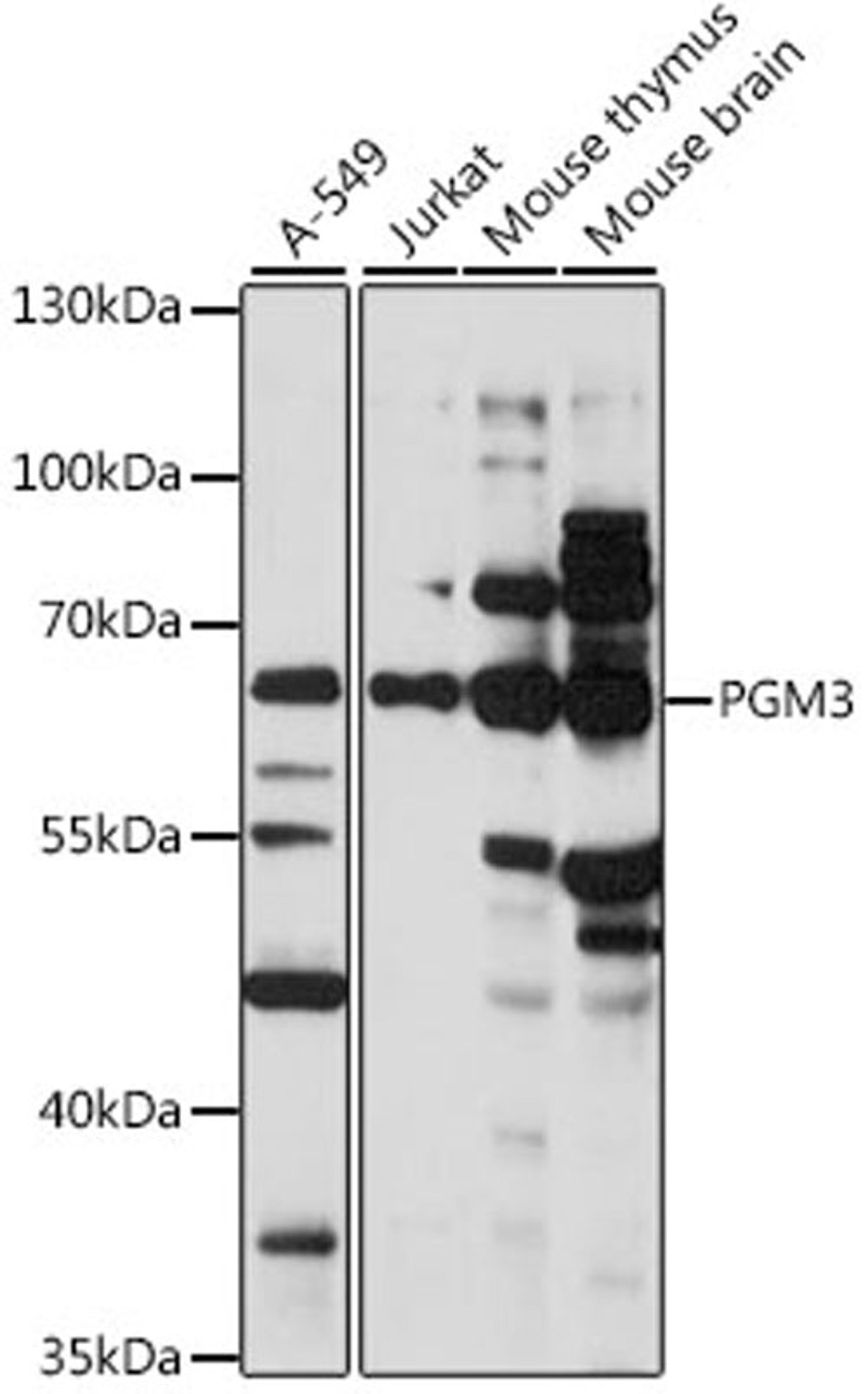 Western blot - PGM3 antibody (A15699)