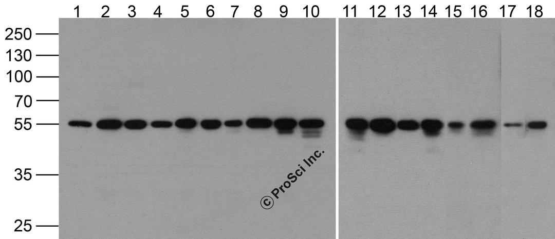 Western blot analysis of alpha-Tubulin in 293, Daudi, Hela, HepG2, Jurkat, K562, NH3T3, Raji, Ramos, U937, Human brain, Mouse brain, Rat Brain, Rabbit Brain, Rabbit Spleen, Zebrafish, Mouse Liver and Chicken liver lysate at 1 μg/mL.