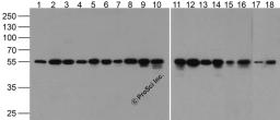 Western blot analysis of alpha-Tubulin in 293, Daudi, Hela, HepG2, Jurkat, K562, NH3T3, Raji, Ramos, U937, Human brain, Mouse brain, Rat Brain, Rabbit Brain, Rabbit Spleen, Zebrafish, Mouse Liver and Chicken liver lysate at 1 μg/mL.