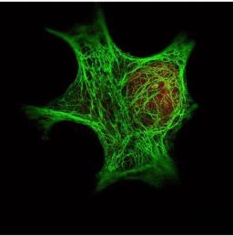 Immunofluorescence analysis of used with Dylight 488 (shown in green) to detect Keratin. Data was collected on a STED-CW TCS-SP5 Confocal system (Leica Microsystems). using HDAC-1 antibody