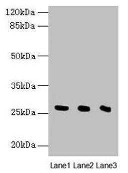 Western blot. All lanes: Nqo2 antibody at 8µg/ml. Lane 1: Rat heart tissue. Lane 2: Mouse liver tissue. Lane 3: Mouse kidney tissue. Secondary. Goat polyclonal to rabbit IgG at 1/10000 dilution. Predicted band size: 27 kDa. Observed band size: 27 kDa