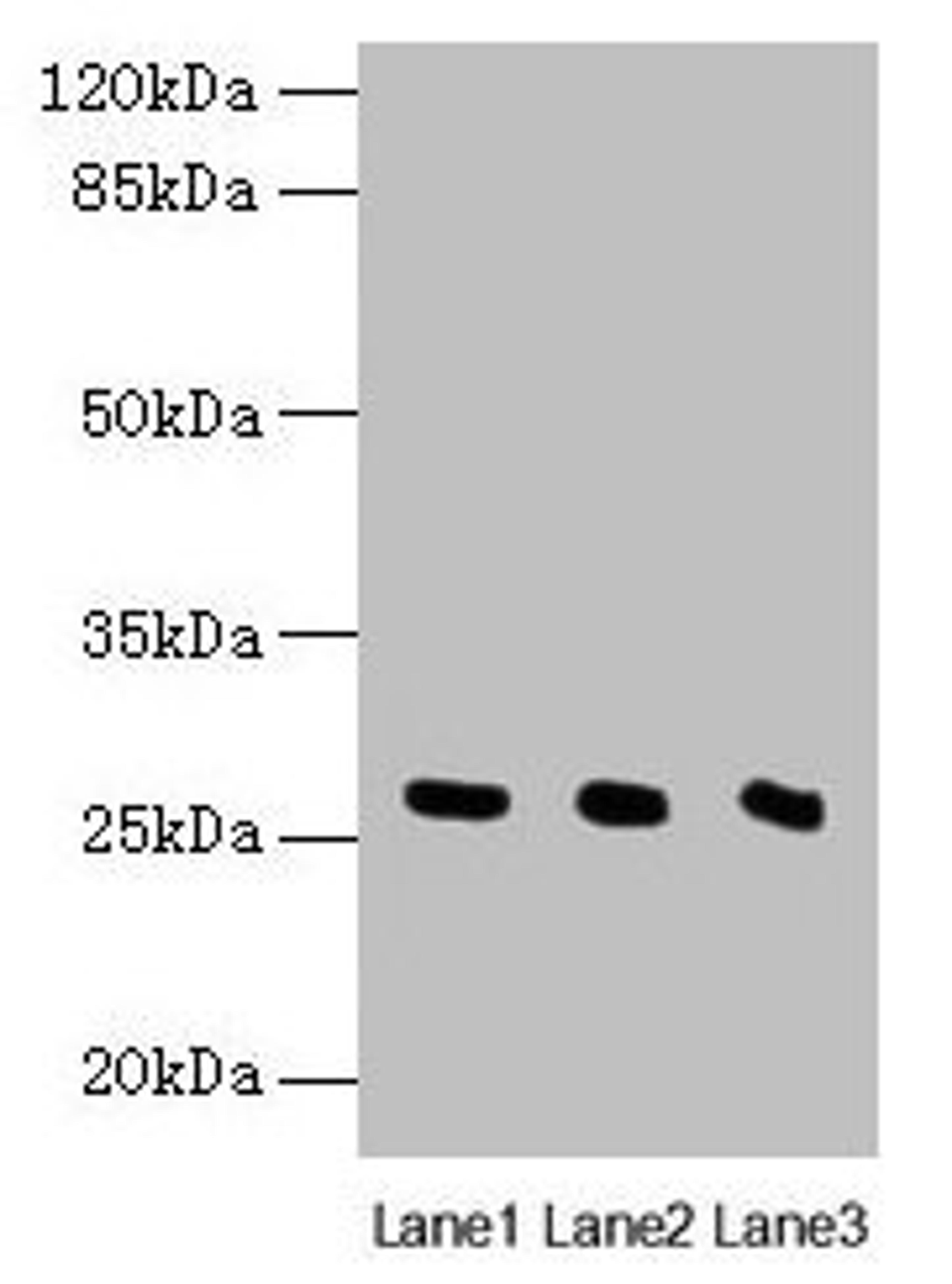 Western blot. All lanes: Nqo2 antibody at 8µg/ml. Lane 1: Rat heart tissue. Lane 2: Mouse liver tissue. Lane 3: Mouse kidney tissue. Secondary. Goat polyclonal to rabbit IgG at 1/10000 dilution. Predicted band size: 27 kDa. Observed band size: 27 kDa