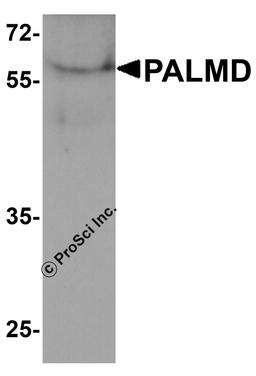 Western blot analysis of PALMD in human bladder tissue lysate with PALMD antibody at 1 μg/ml.