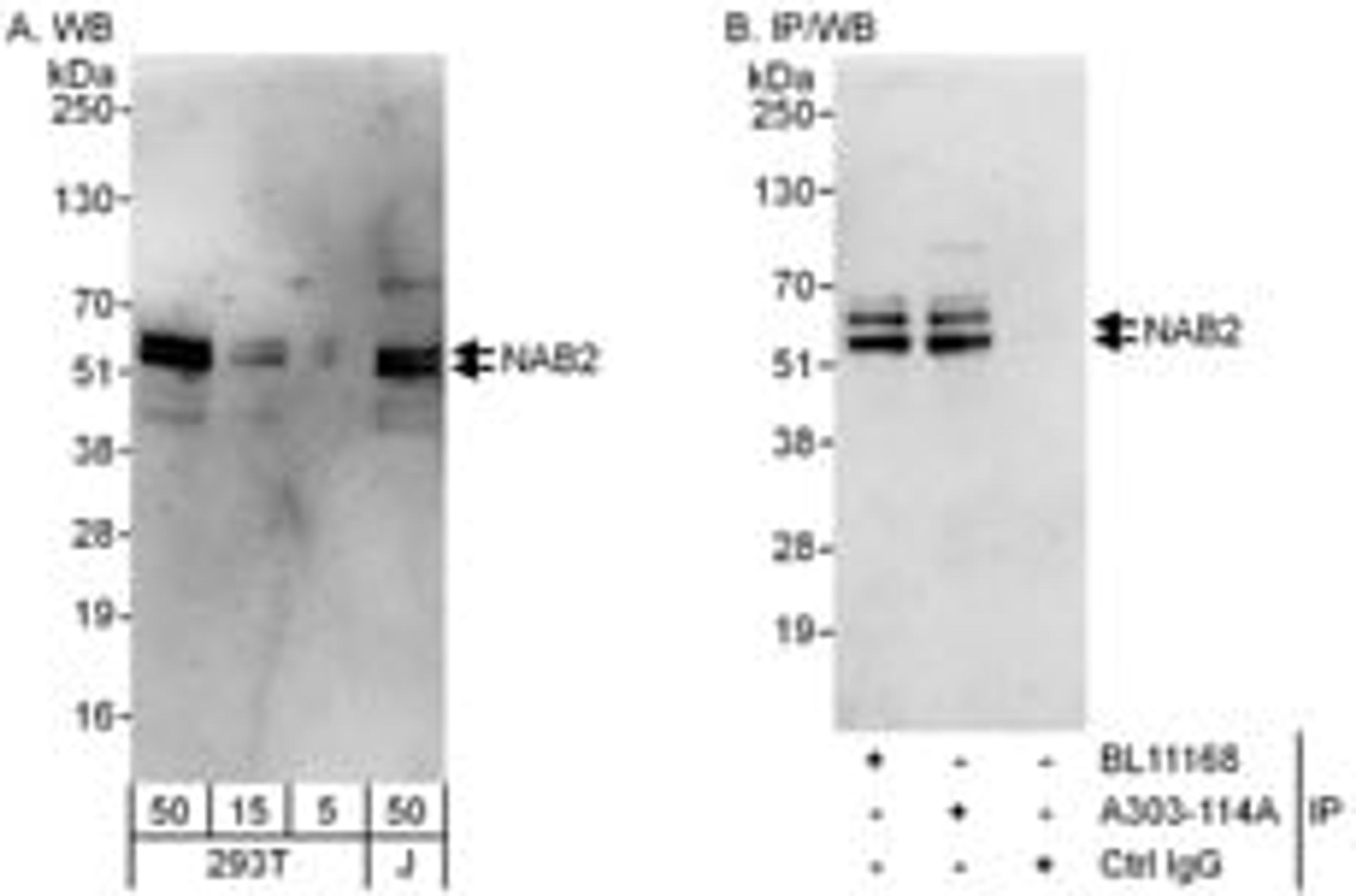 Detection of human NAB2 by western blot and immunoprecipitation.