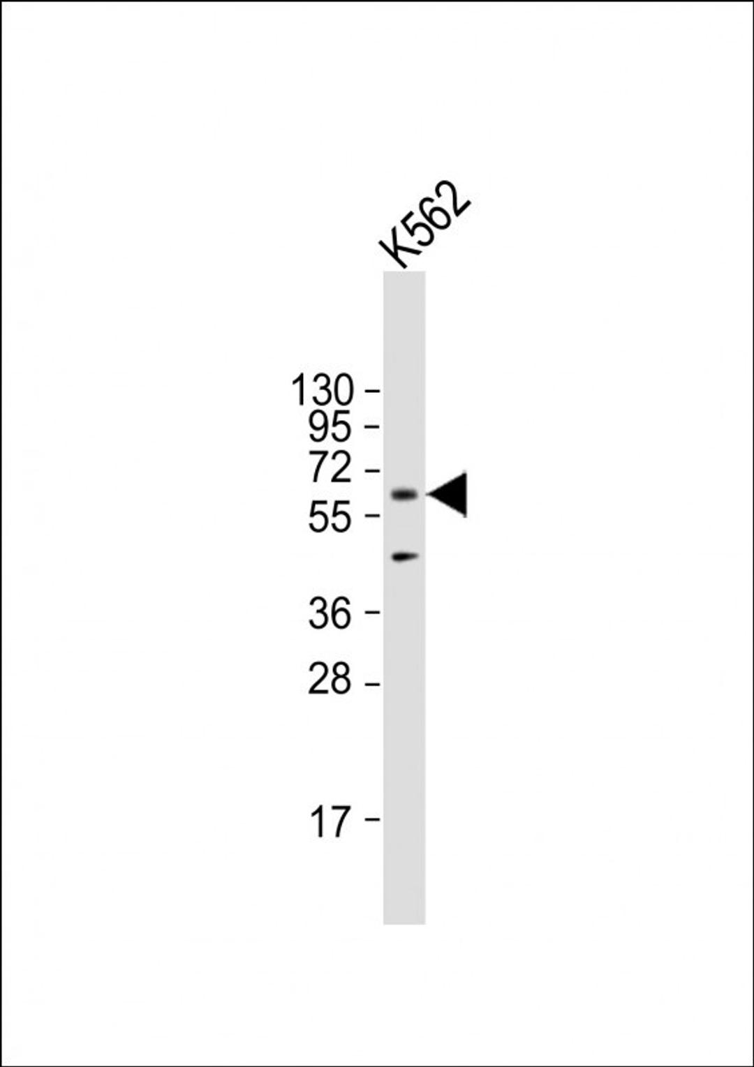 Western Blot at 1:2000 dilution + K562 whole cell lysate Lysates/proteins at 20 ug per lane.