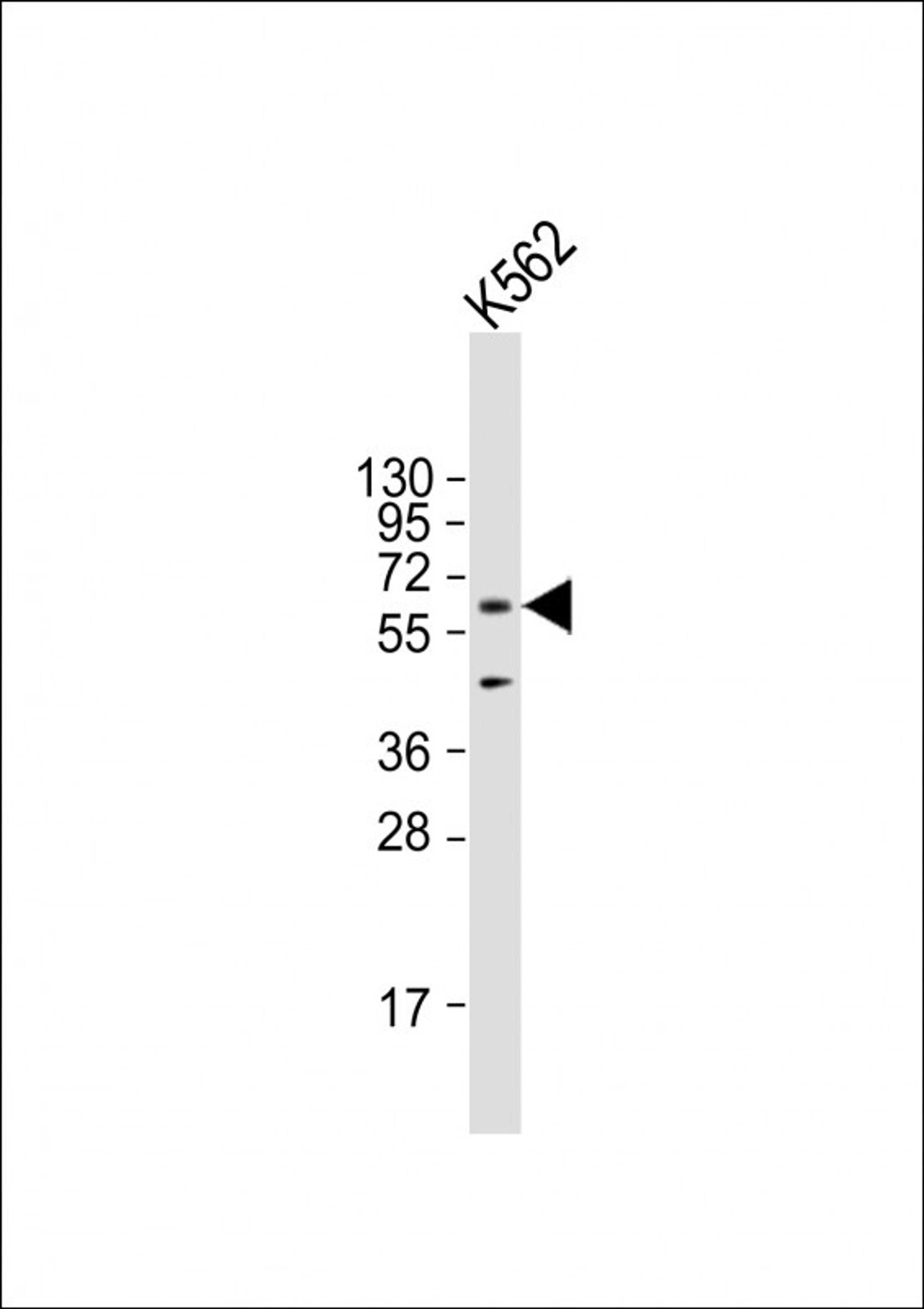 Western Blot at 1:2000 dilution + K562 whole cell lysate Lysates/proteins at 20 ug per lane.