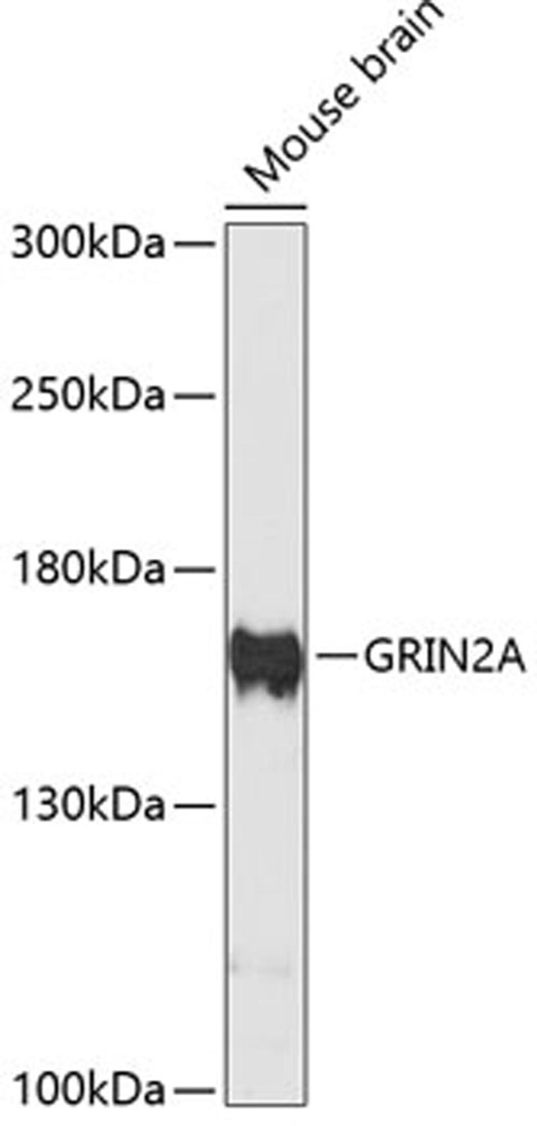 Western blot - GRIN2A antibody (A13863)