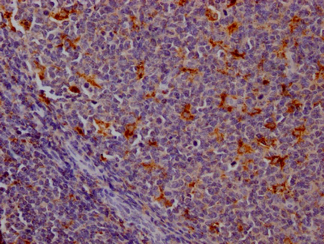 IHC image of CSB-RA788455A0HU diluted at 1:100 and staining in paraffin-embedded human tonsil tissue performed on a Leica BondTM system. After dewaxing and hydration, antigen retrieval was mediated by high pressure in a citrate buffer (pH 6.0). Section was blocked with 10% normal goat serum 30min at RT. Then primary antibody (1% BSA) was incubated at 4℃ overnight. The primary is detected by a Goat anti-rabbit IgG polymer labeled by HRP and visualized using 0.05% DAB.