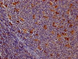 IHC image of CSB-RA788455A0HU diluted at 1:100 and staining in paraffin-embedded human tonsil tissue performed on a Leica BondTM system. After dewaxing and hydration, antigen retrieval was mediated by high pressure in a citrate buffer (pH 6.0). Section was blocked with 10% normal goat serum 30min at RT. Then primary antibody (1% BSA) was incubated at 4℃ overnight. The primary is detected by a Goat anti-rabbit IgG polymer labeled by HRP and visualized using 0.05% DAB.