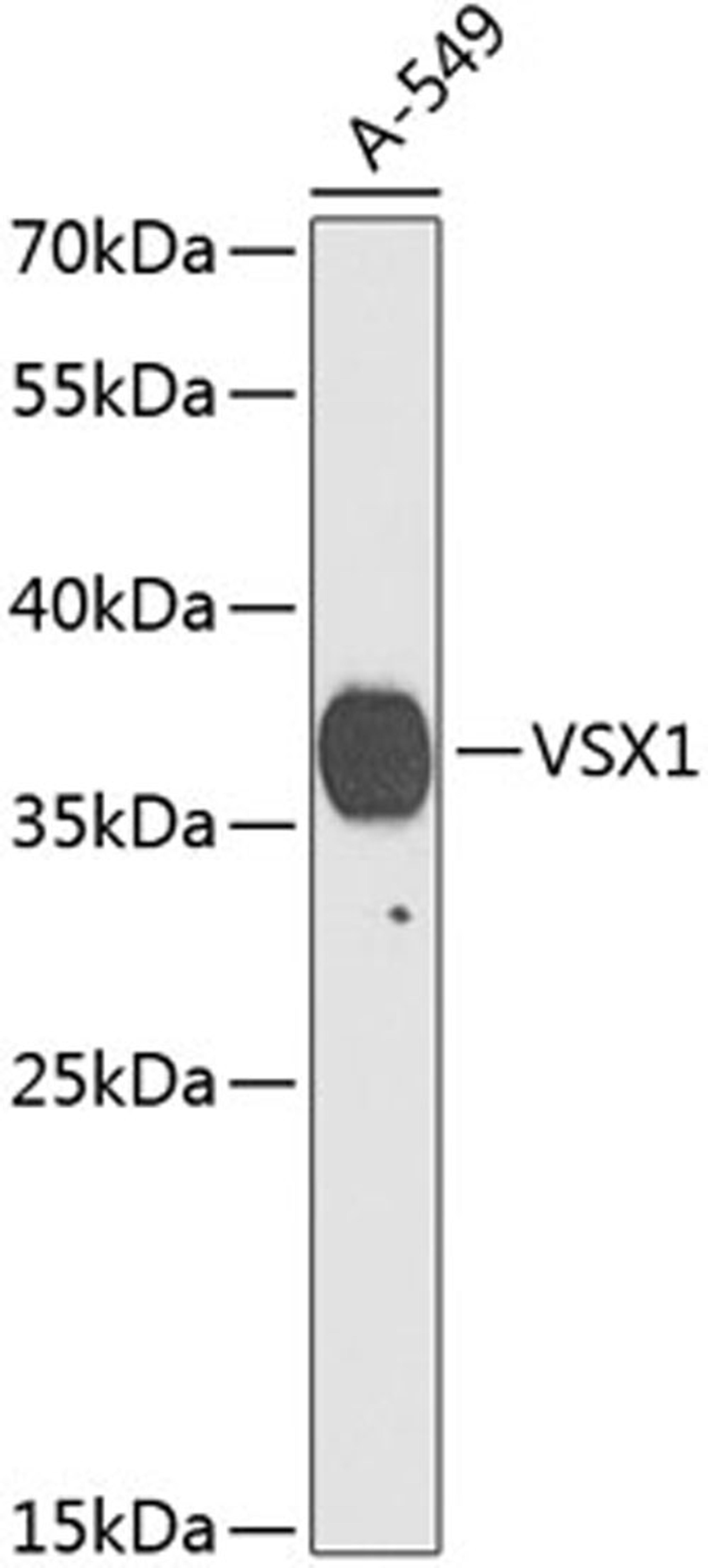 Western blot - VSX1 Antibody (A9800)