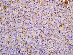 Immunohistochemical staining of mouse transplantable tumor tissue using PDL1 antibody.