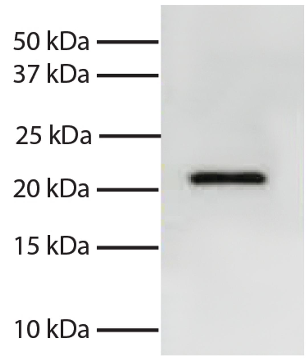 Total cell lysates from Jurkat cells were resolved by electrophoresis, transferred to PVDF membrane, and probed with Mouse Anti-Human Bid-UNLB (Cat. No. 99-753). Proteins were visualized using Goat Anti-Mouse IgG, Human ads-HRP secondary antibody and chem