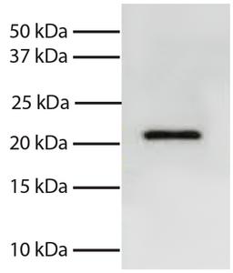 Total cell lysates from Jurkat cells were resolved by electrophoresis, transferred to PVDF membrane, and probed with Mouse Anti-Human Bid-UNLB (Cat. No. 99-753). Proteins were visualized using Goat Anti-Mouse IgG, Human ads-HRP secondary antibody and chem