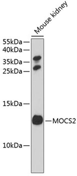 Western blot - MOCS2 antibody (A3965)