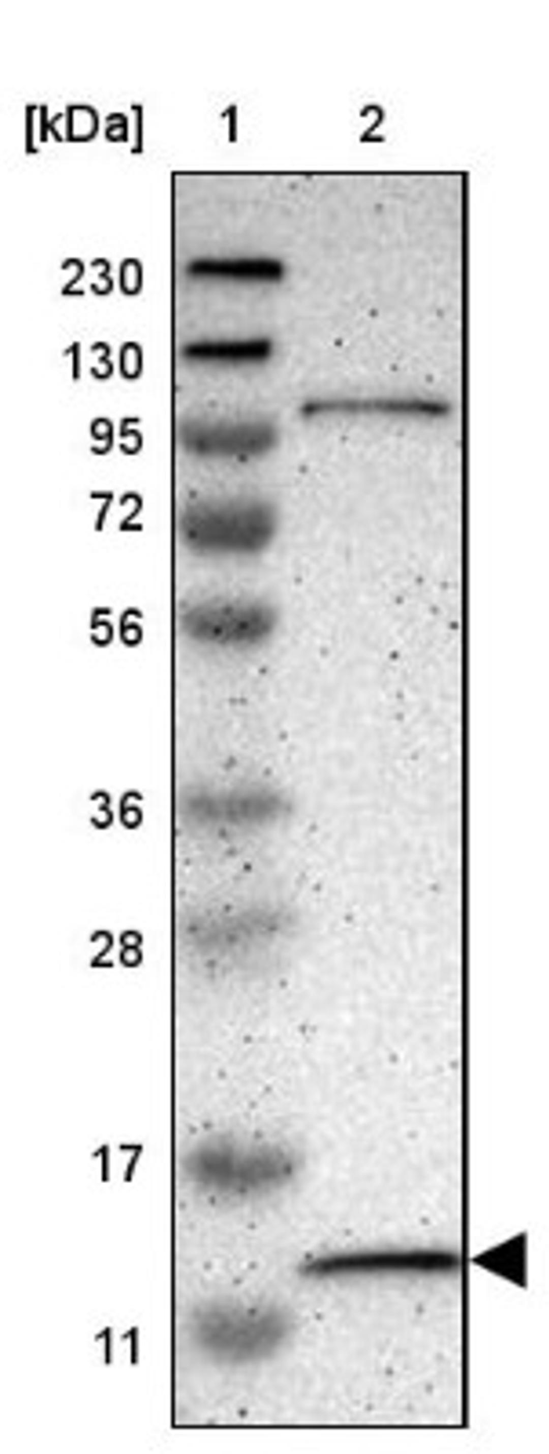 Western Blot: MRPL52 Antibody [NBP1-86094] - Lane 1: Marker [kDa] 230, 130, 95, 72, 56, 36, 28, 17, 11<br/>Lane 2: Human cell line RT-4