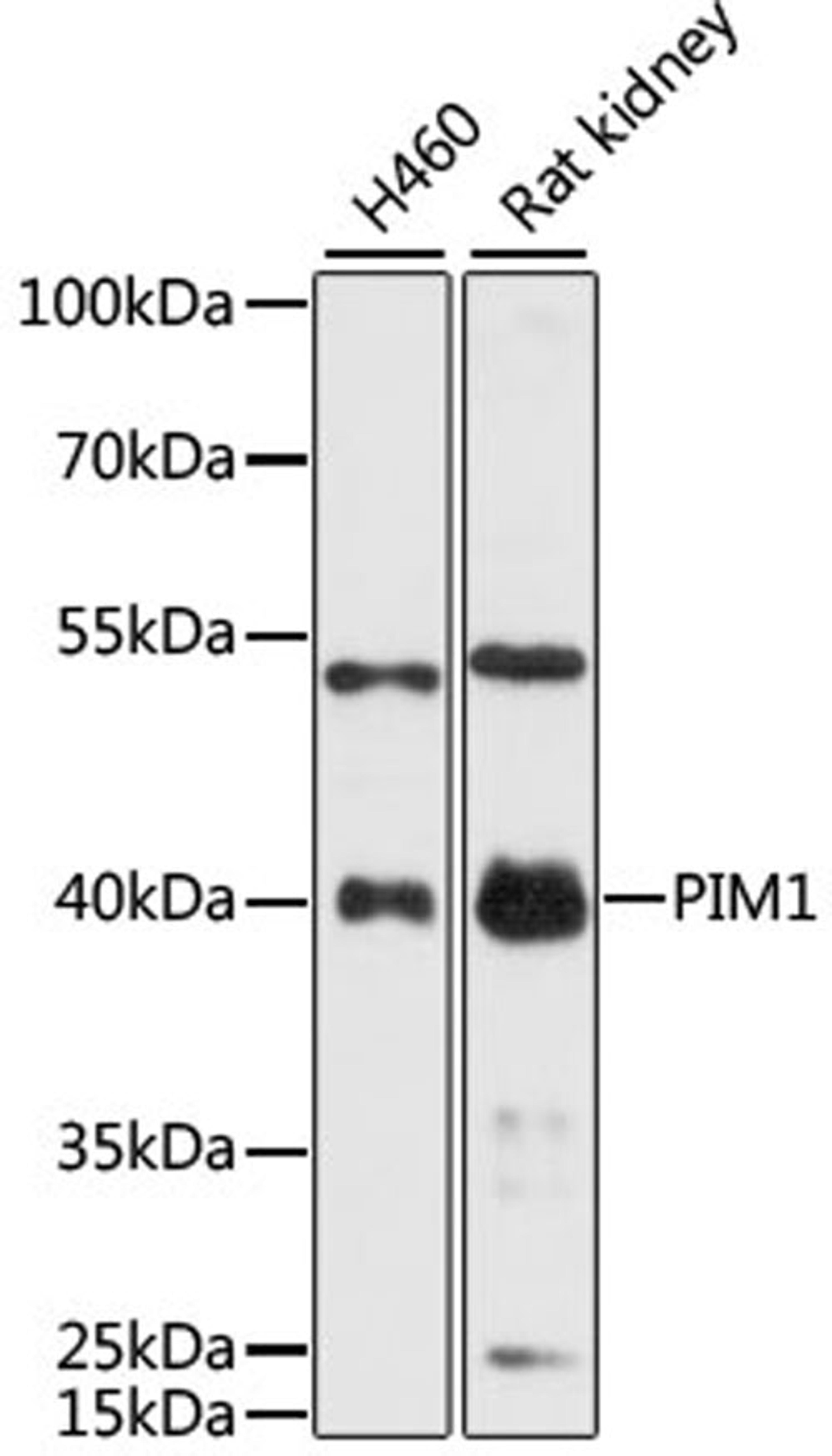 Western blot - PIM1 antibody (A14210)