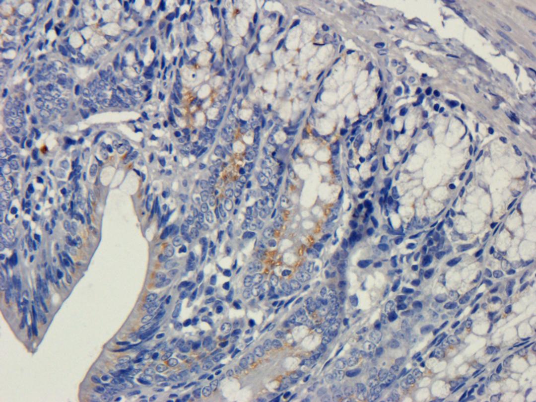 IHC-P image of rat colon tissue using anti-VEGFA (5 ug/ml)