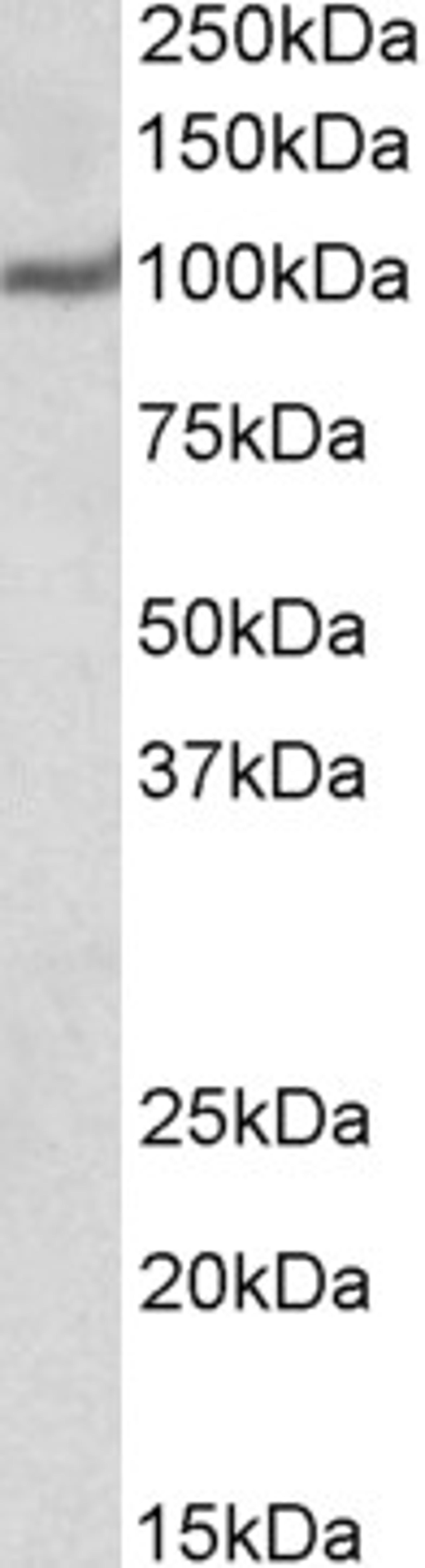 Approx 100kDa band observed in Human Heart lysates (calculated MW of 104kDa according to NP_955475.1). Recommended concentration: 1-3ug/ml.