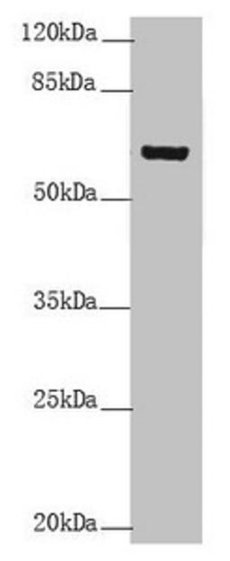 Western blot. All lanes: KRT6B antibody at 5.39µg/ml + A431 whole cell lysate. Secondary. Goat polyclonal to rabbit IgG at 1/10000 dilution. Predicted band size: 60 kDa. Observed band size: 60 kDa