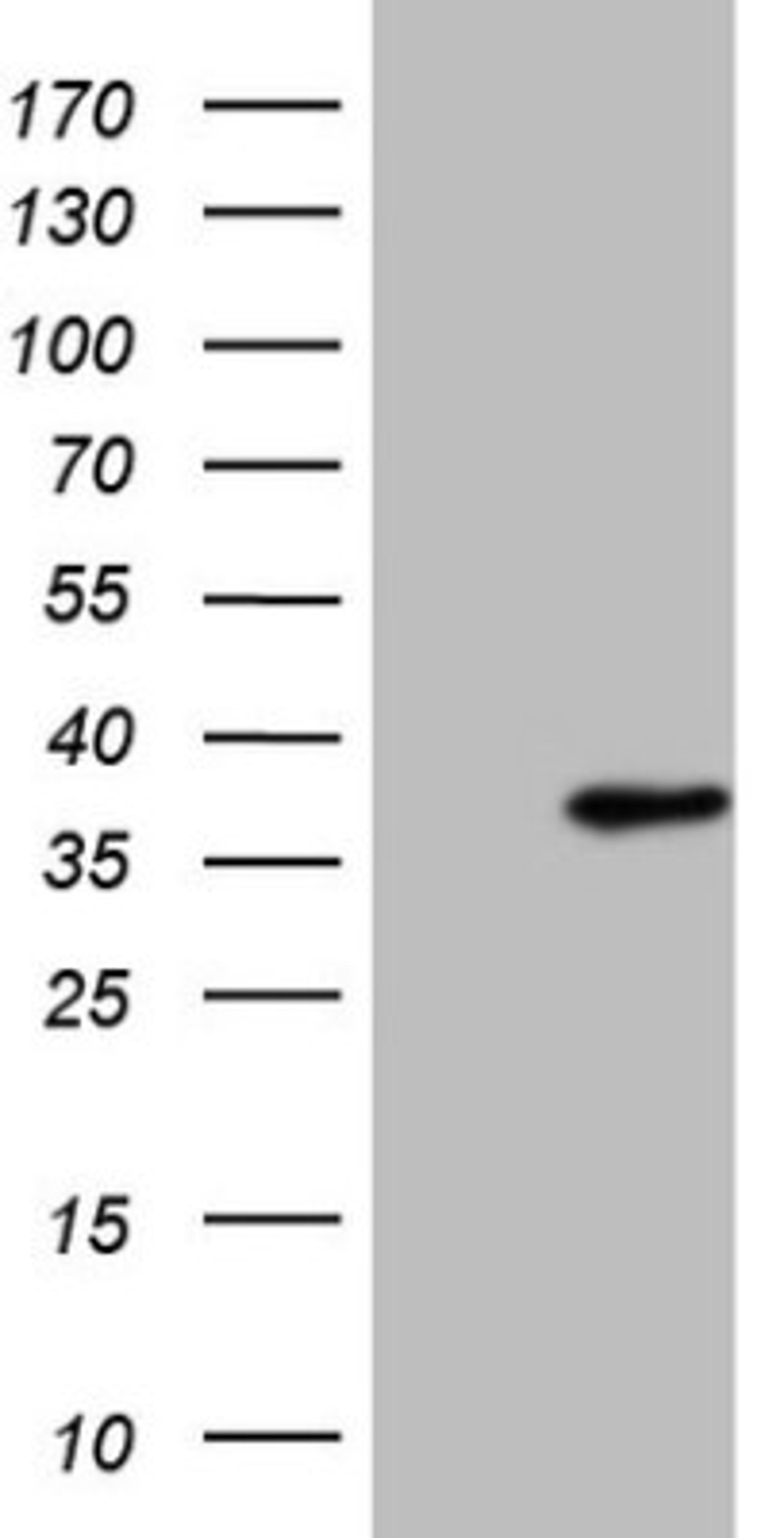 Western Blot: SFRS9 Antibody (5G7) [NBP2-45429] - Analysis of HEK293T cells were transfected with the pCMV6-ENTRY control (Left lane) or pCMV6-ENTRY SRSF9.