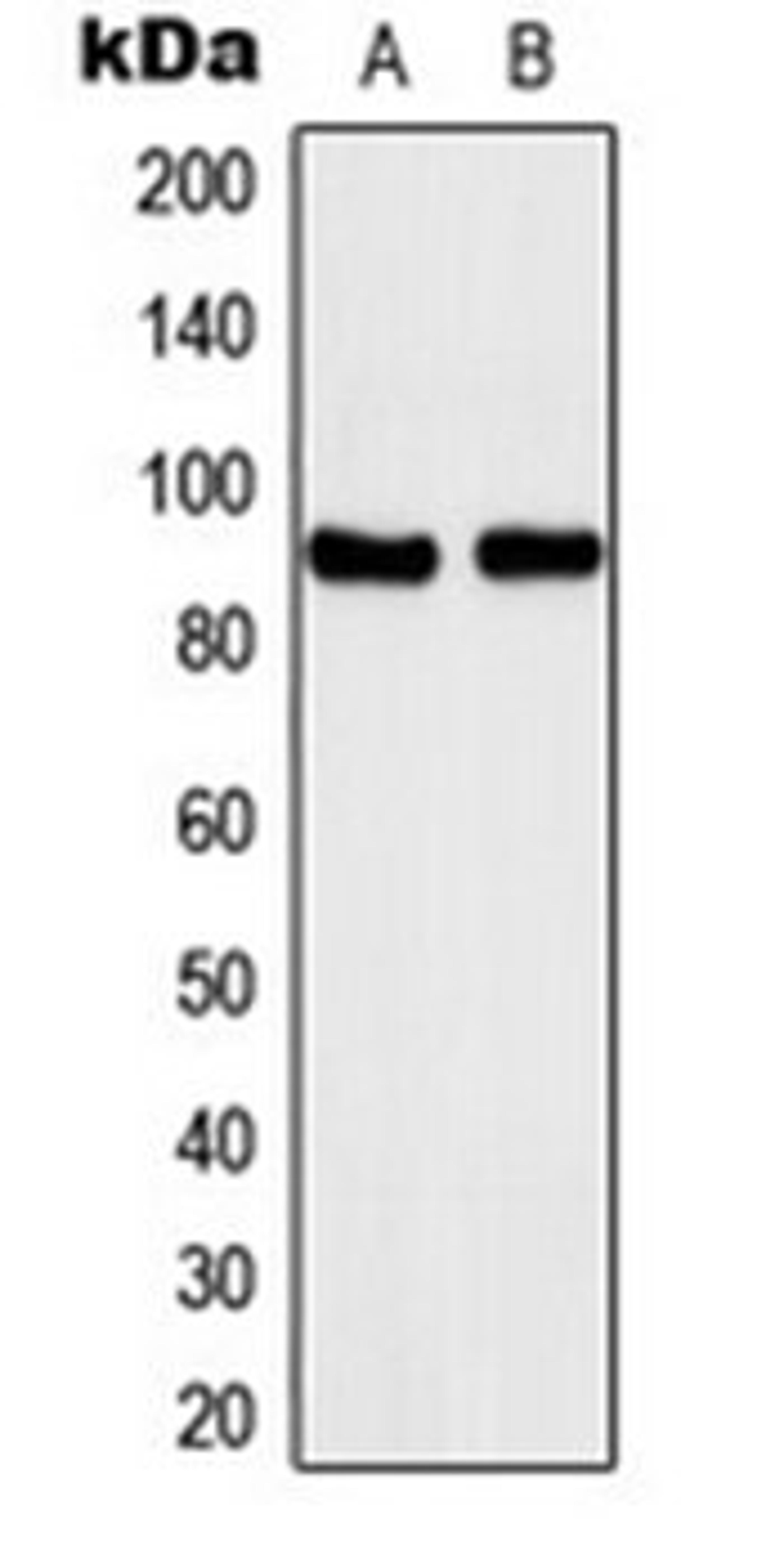 Western blot analysis of A431 (Lane 1), Jurkat (Lane 2) whole cell lysates using Kanadaptin antibody