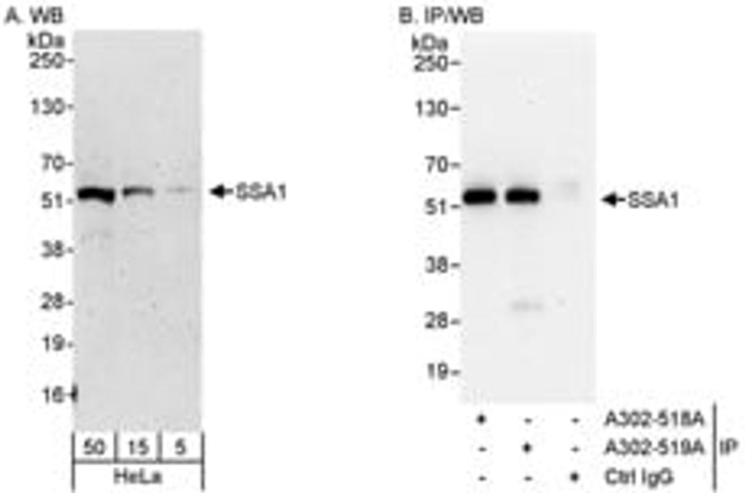 Detection of human SSA1 by western blot and immunoprecipitation.