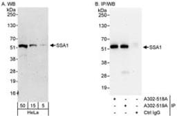 Detection of human SSA1 by western blot and immunoprecipitation.