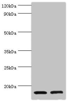 Western blot. All lanes: CST3 antibody at 2µg/ml. Lane 1: High values of serum at 1: 10. Lane 2: High values of serum at 1: 100. Secondary. Goat polyclonal to rabbit IgG at 1/10000 dilution. Predicted band size: 16 kDa. Observed band size: 16 kDa