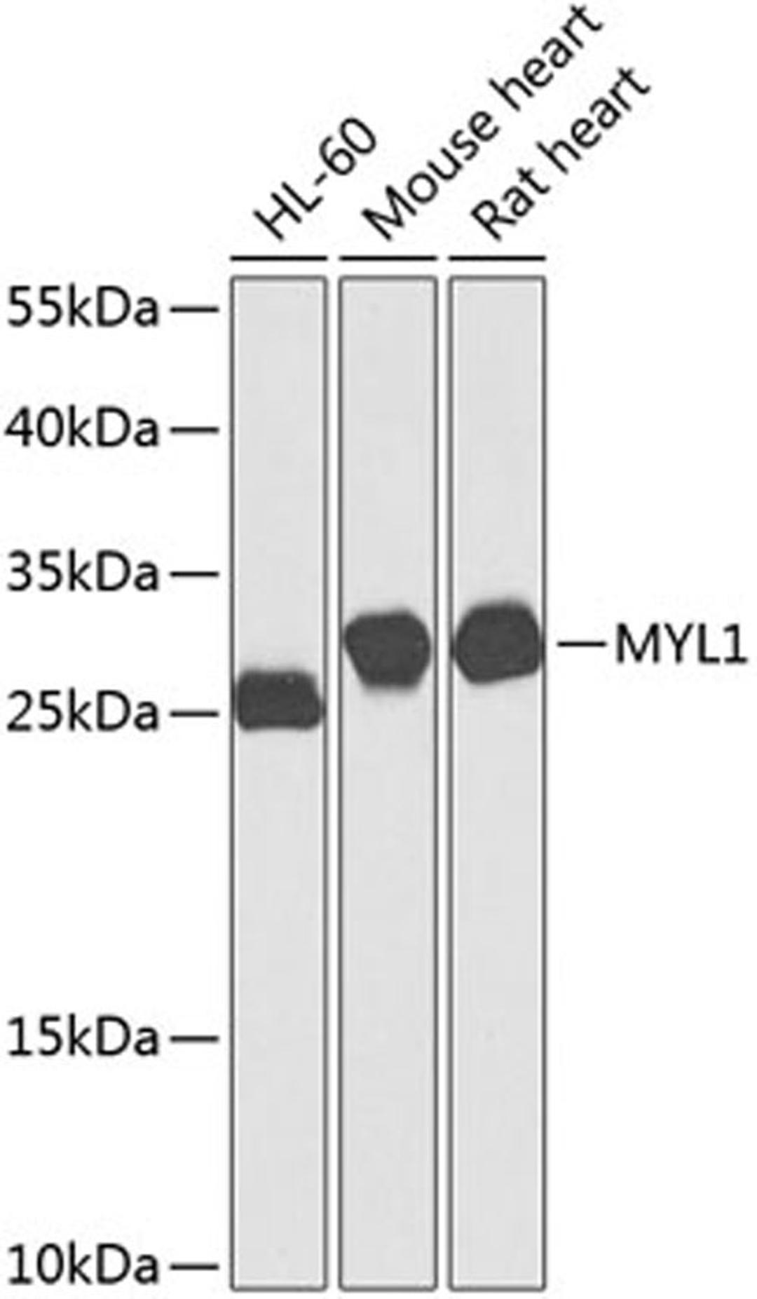 Western blot - MYL1 antibody (A8438)