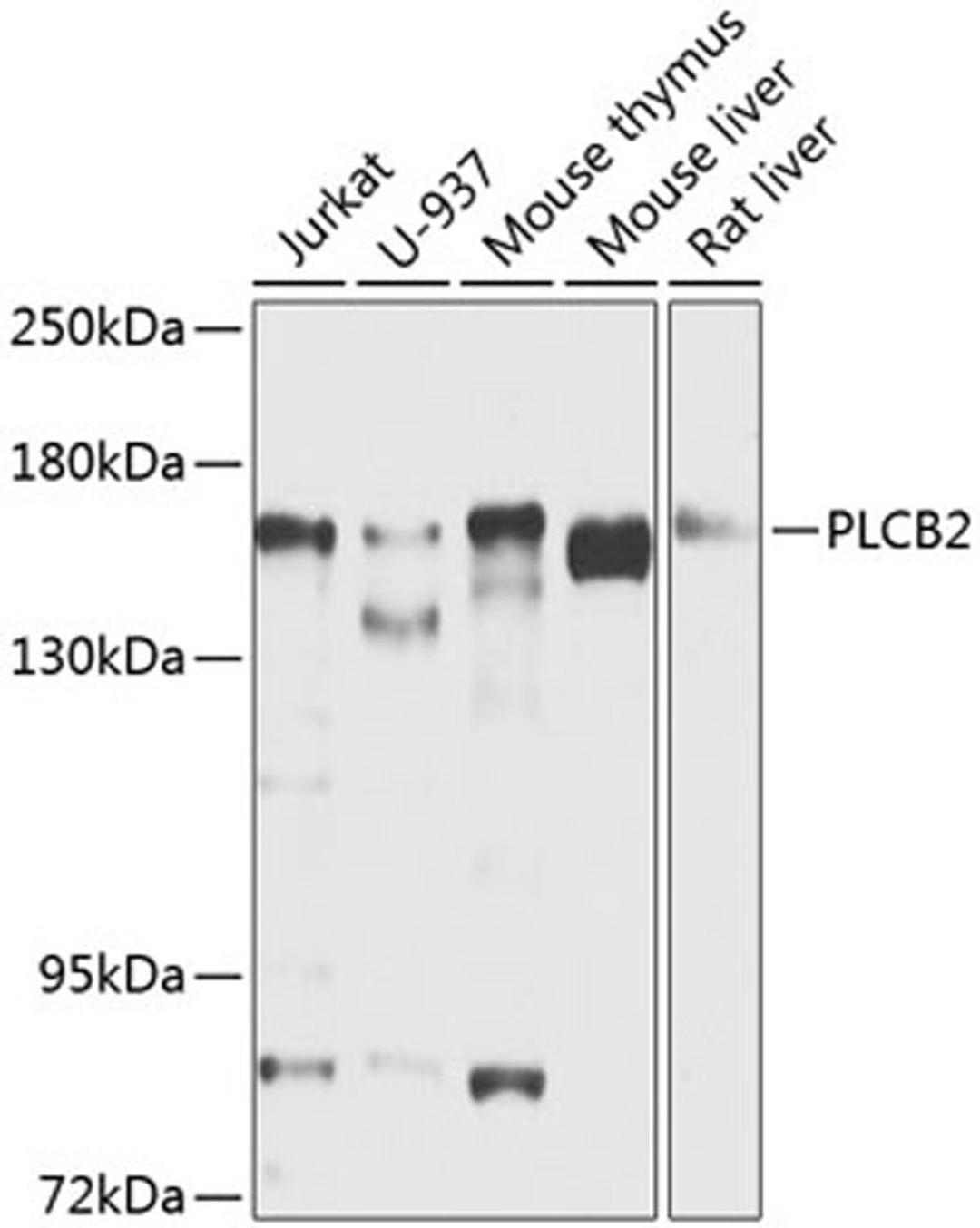 Western blot - PLCB2 antibody (A8141)