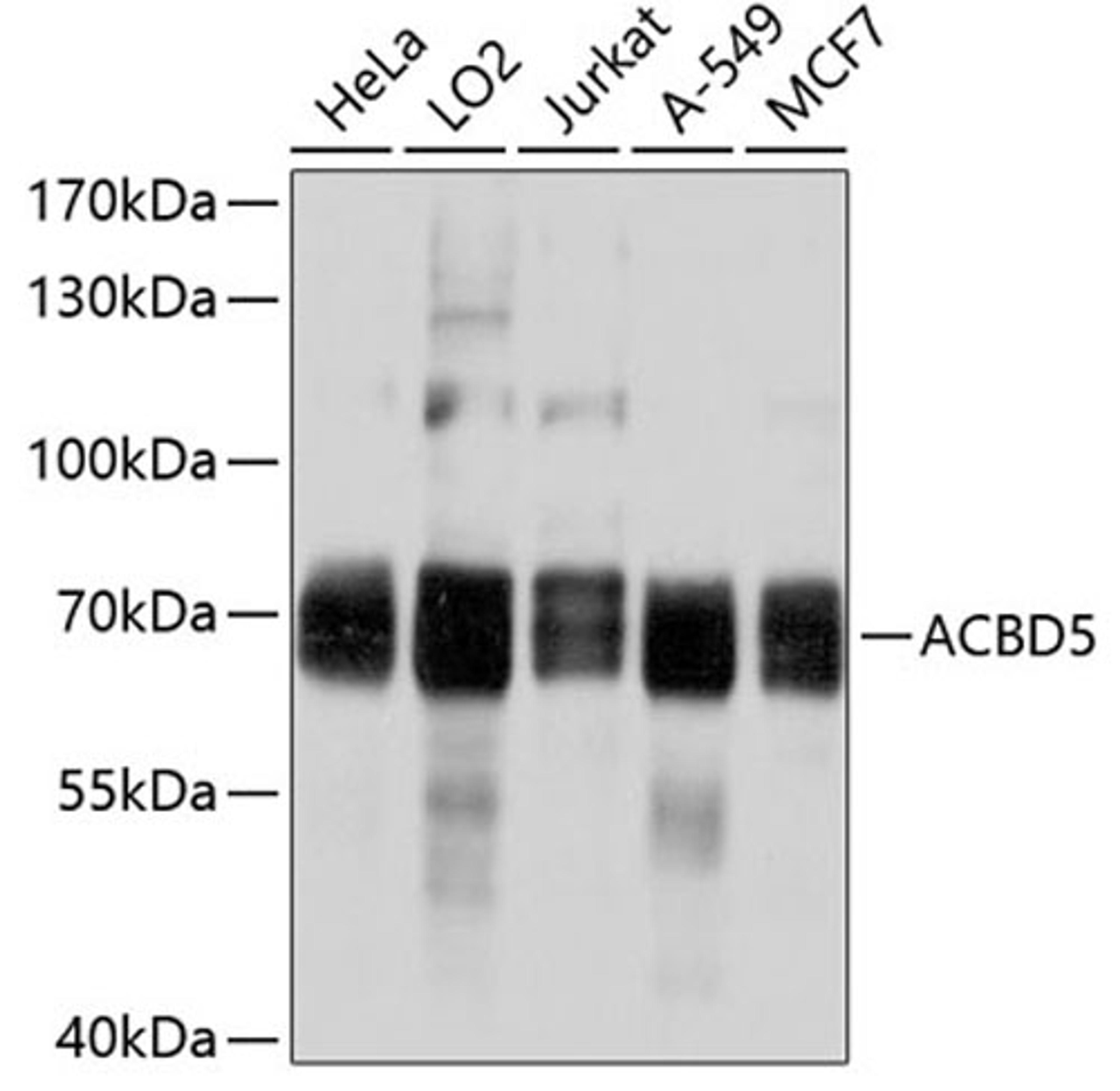 Western blot - ACBD5 antibody (A10595)